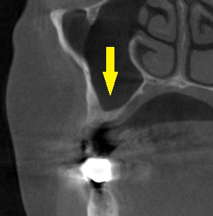 インプラント治療で選ばれる名古屋の歯科医院